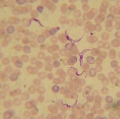 Hemoflagellate, Order Kinetoplastida, Section Salivaria
Africa
~2.5x size of red blood cell. Has a lot of "stuff"/organelles in body.
Trypomastigote in vertebrate, epimastigote in insect. 


Three subspecies: 
1. T. brucei brucei: causes Nagana in...