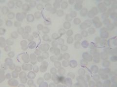 Hemoflagellates, Order Kinetoplastida, Section Stercoraria


Worldwide distribution in Rattus sp. 
Vector: Rat flea
Mild pathology. Trypomastigotes in blood.


~2.5x size of red blood cell, more transparent. kinetoplast distinct.