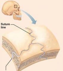 -dense regular connective tissue connects skull bones 
-function: synarthrosis
