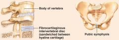 -fibrocartilage pad between bones 
-function: amphiarthrosis 
