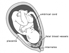 life threatening to fetus

when membranes rupture, fetal vessels are torn leading to sig blood loss in fetus

painless to mom

if seen, requires c-section