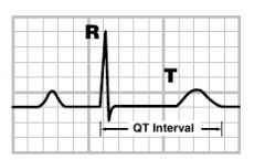 QTm = Durée entre le début du QRS et la fin de l'onde T.


QTc = QTm/√R-R précédent. ( Formule de Bazett)


Pour des fréquences cardiaques rapides ou basses d'autres formules sont préférables.


Astuce: En dehors des fréquences ext...