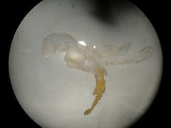 Phylum Arthropoda, Subphylum Crustacea, Class Malocostraca, Order Isopoda


Endoparasites of crabs
Highly modified
Two host life cycle with epicardium (IH) and cryptoniscus larvae (DH)

Adults in crab host- hemocoel castrator
Females highly modifi...