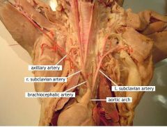 Green = Axillary Artery
White = Axillary Vein