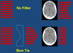 more beam attenuation near edges than at its center. The edge of patients do not require as much radiation as the center to form the image. this reduces scatter and makes the radiation dose more uniform throughout the patient.  Limits range of int...