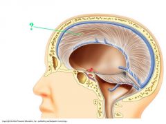A longitudinal fold in the meningeal layer that divides the two hemispheres