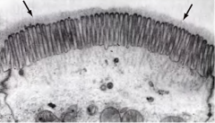 Por exemplo nas células epiteliais, no exterior das microvilosidades. 