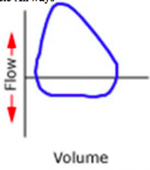 What is this kind of expiratory flow volume loop indicative of?