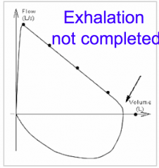 Incomplete expiration: a sudden drop at the right end of the loop, the loop is cut off