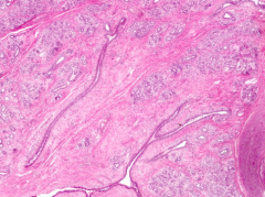 Sexual maturity - INACTIVE:
- Alveoli are not well developed
- Dense fibrous CT and adipose tissue (interlobular CT) are abundant