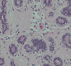 What kinds of cells are adjacent to the epithelium of the ducts of the mammary glands? How can you spot them?