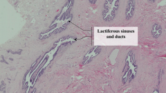 Lactiferous sinuses and ducts