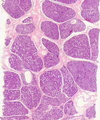 Human mammary gland during pregnancy
- Numerous, well-developed alveoli are seen in the mammary gland tissue
- CT between lobules (interlobular) is reduced
- Intralobular CT is more cellular than fibrous
- Actively secreting alveolar cells hav...
