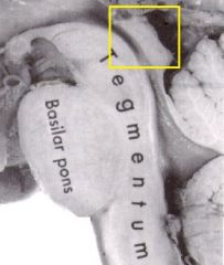 Identify this structure on the sagittal view of the brainstem. It is composed of the superior and inferior colliculi. 
