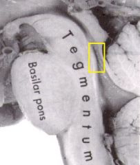Identify this structure on the sagittal view of the brainstem.
