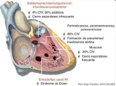 1. localizadas por debajo de la válvula semilunar en el septo conal o de salida
2. perimembranosa
3. canal AV: Septo de entrada inmediatamente inferior a la válvlua auriculo ventricular.
4. muscular