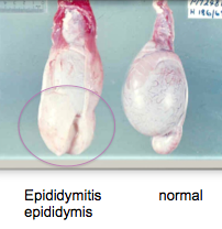 On palpation of a ram, localised hard enlargements of the epididymis (tail) are felt. Possible dx?