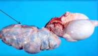 This is seen on PM of a ram with enlarged scrotum. Dx?