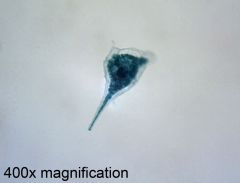 Has two flagella found at right angles.  


Are marine.


Heterotrophic.


Has chitnous plates. 