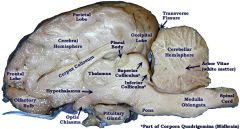 cerebrum (large part of brain), cerebellum, spinal cord, medulla oblongata,pons, pituitary gland, olfactory bulb, optic chiasma, frontal lobe, parietal lobe, temporal lobe, occipital lobe