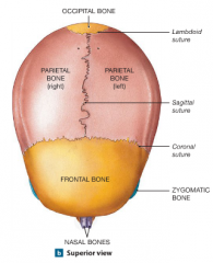 Occipital Bone, Parietal Bone (Left and Right), Frontal Bone, and Nasal Bones 