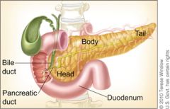 Cancer of the pancreatic head obstructing bile duct