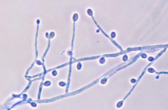 anamorph phase
Septate hyphae
One-celled, egg-shaped conidia (anneloconidia) at the tips of conidiaproducing hyphae (annellophores)