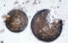 Dark-pigmented cleistothecia (multicellular structures in which asci and ascospores are formed and held) are found below the surface of the agar