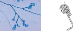 causes phaeohyphomycosis
Tube-like phialides without collarettes elicit terminal balls of conidia. The conidia tend to fall down to the sides of the phialides.
Morphologically resembles Exophiala jeanselmei. However Wangiella dermatitidis will gro...