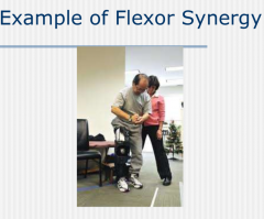 - Patterned movement characterized by co-contraction of flexors and extensors
= UE: Flexor synergy, LE: Extensor synergy