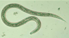 Hookworm 

 Filariform larvae: (identical for both genera).

						Infective stage: RARELY SEEN