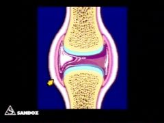 name the synovial joint structure