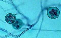 Some similarities to fungi:
- Has hyphae
- No plastids


Different from fungi:
- Has cellulose in cell walls.
- Flagellated cells (spores)