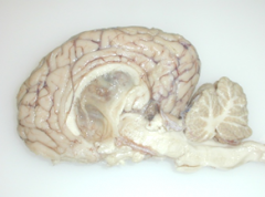 tissue from a 15 yo oldenberg mare w/ a hx of 3 neuro episodes w/in the past year.  mdx? ddx?