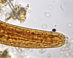 Rhabditiform larvae in feces.