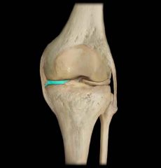 Name the knee joint structure
(anterior view)