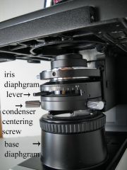 What does the iris diaphragm do?