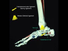 Tearing/ streatching pf which ligament would cause you to be flat footed?