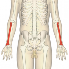 radius

- lateralt vid anatomisk grund
