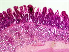 1)identify the organ?
2) what type of glands are on the bottom