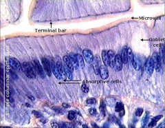 1) what is the classification of this epithelium