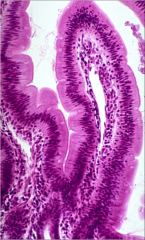 1) identify this structure?
2) what type of cells are in its lamina propina?
3) what type of tissue