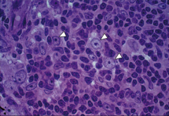 identify the cell pointed by white arrow?