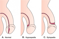 Urethral opening on TOP of the penis (dorsal surface)