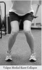 inc their quadriceps strength > their hamstring strength, putting them at risk for ACL injury, ACL prevention programs based on improving dynamic control of the knee by emphasizing hamstring strengthening should be instituted for girls after menar...