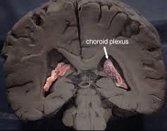 Choroid Plexus
