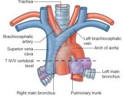pericardium
pulmonary trunk
arch of the aorta
trachea (bifurcating)
R & L main bronchi
articulation btwn sternum & rib 2