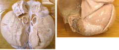 tissue from adult ram with swollen scrotum.  mdx? causes?