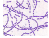 Gram +ve spore-forming bacterial rod- what is it?