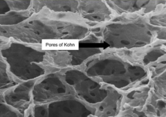 - Fenestrated
- Pores of Kohn
- Important for exchange of substances
